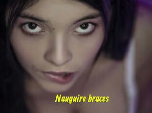 Nauguire_braces